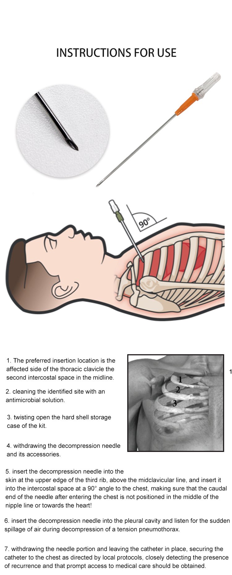 Ifak Tactical Disposable Chest Tension Pneumothorax Decompression Needle