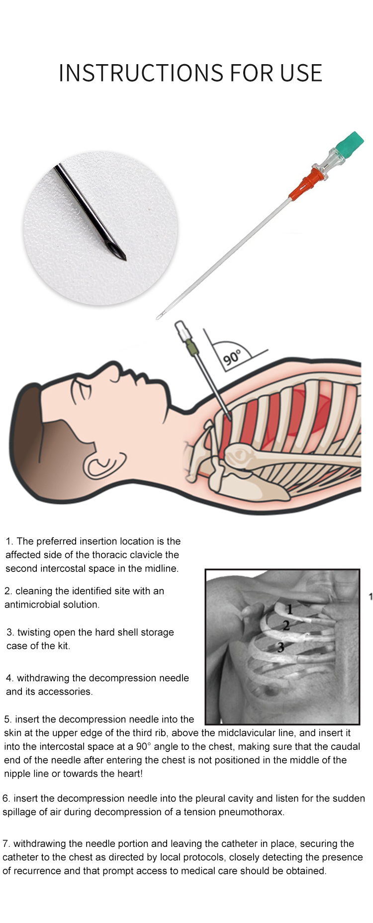 High Quality Disposable Chest Tension Pneumothorax Decompression Needle