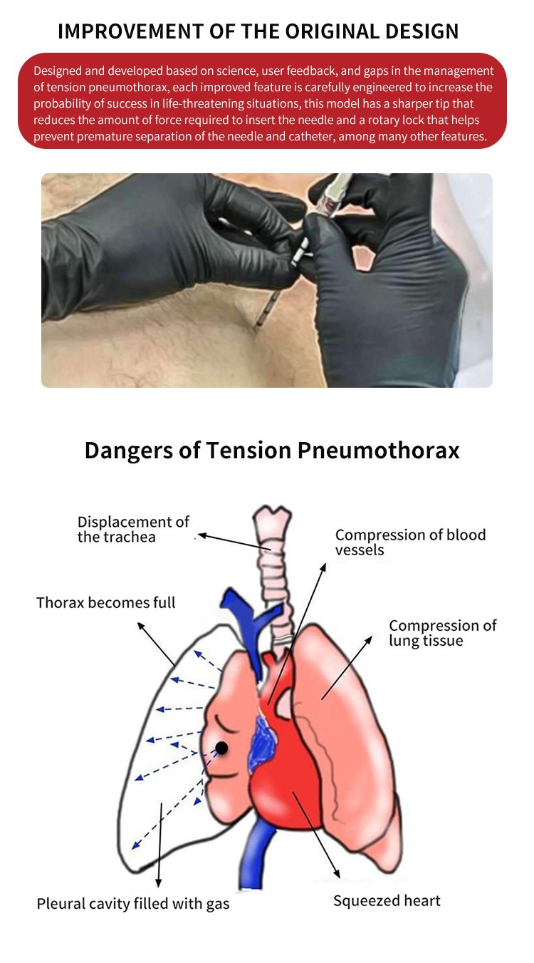 Thoracic tension chest decompression needle, sternal puncture needle, Ifak tactical disposable use