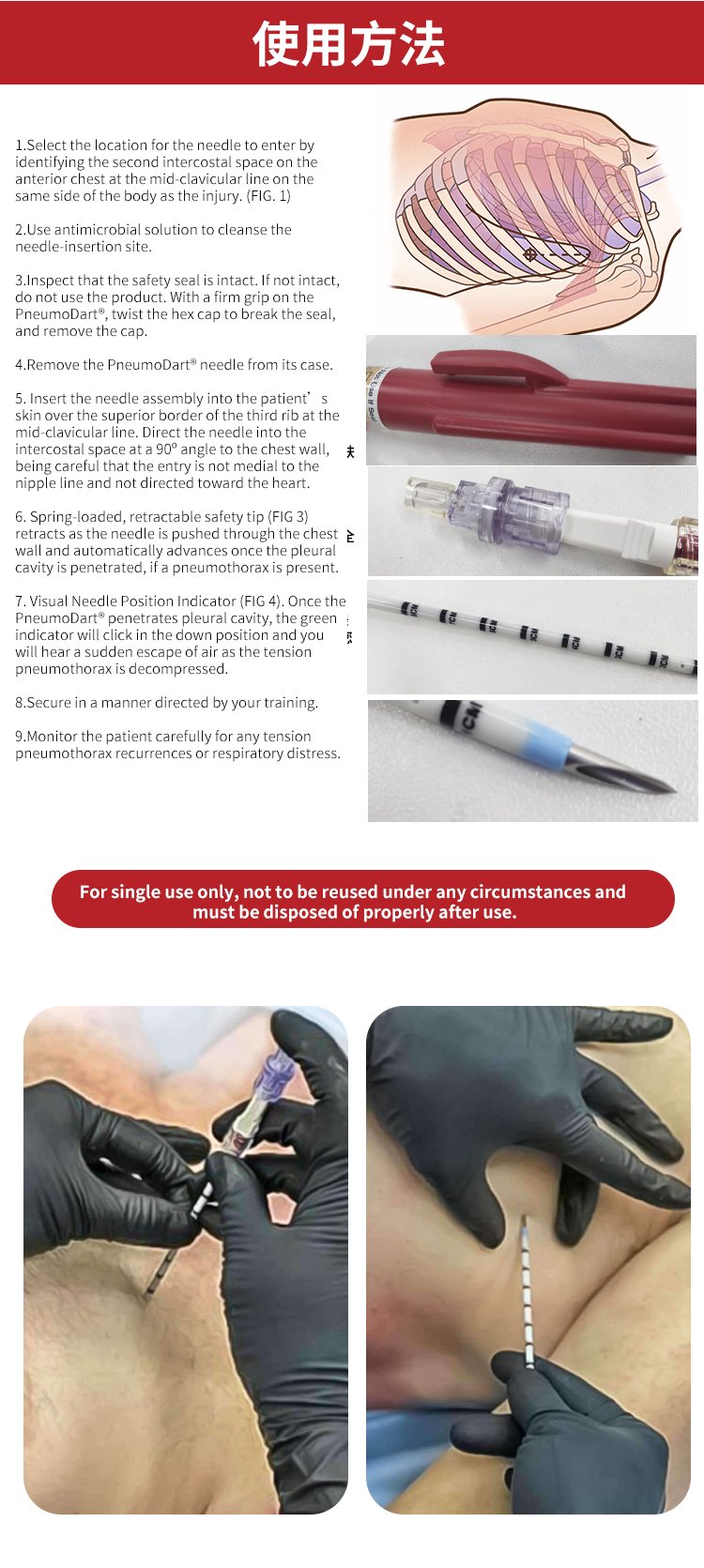 Thoracic tension chest decompression needle, sternal puncture needle, Ifak tactical disposable use