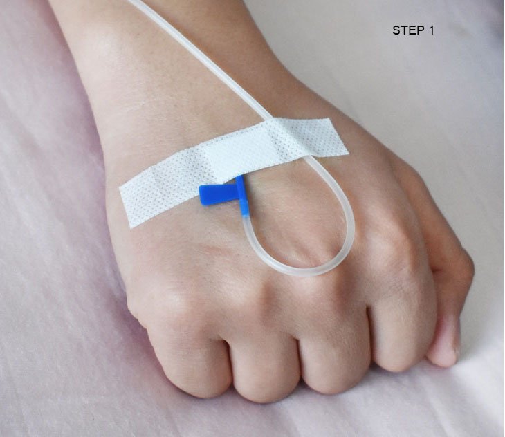 Non-Woven Dressing Medical Infusion Plaster Stickers Wound Infusion Dressings