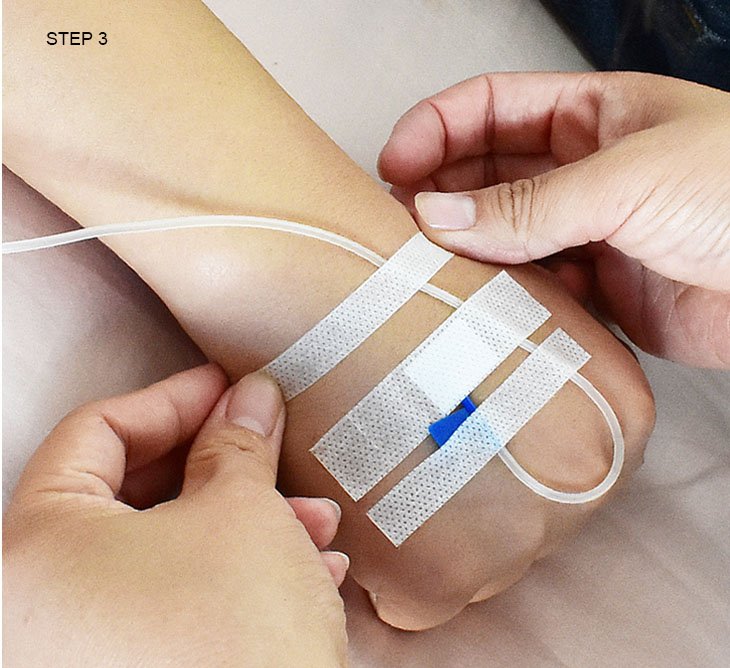 Non-Woven Dressing Medical Infusion Plaster Stickers Wound Infusion Dressings