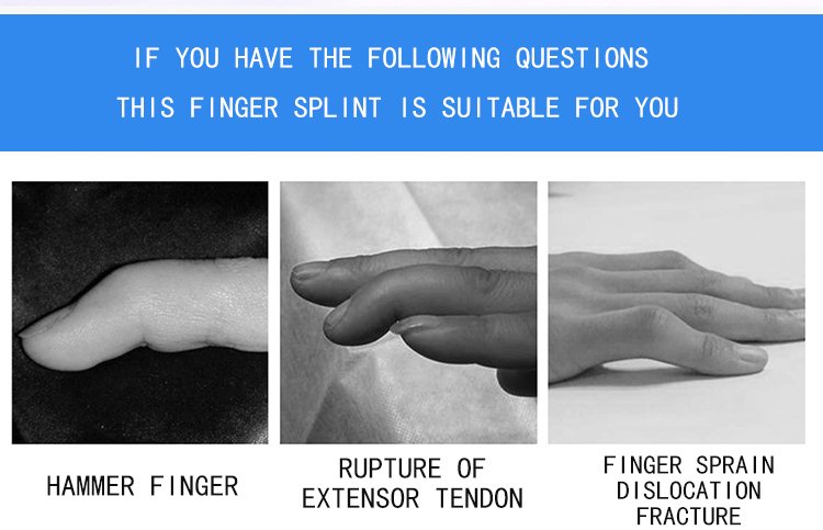 Manufacturer Direct Sales Finger Fixation Clamp Aluminum Alloy Sponge Finger Fracture Fixation Set Finger Orthotic Device
