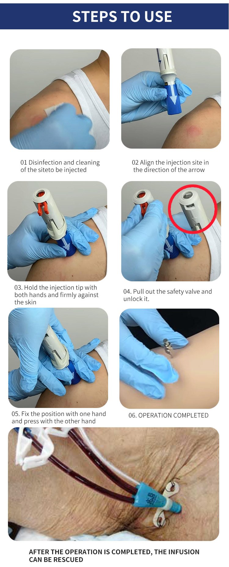 Disposable Bone Injection Rod