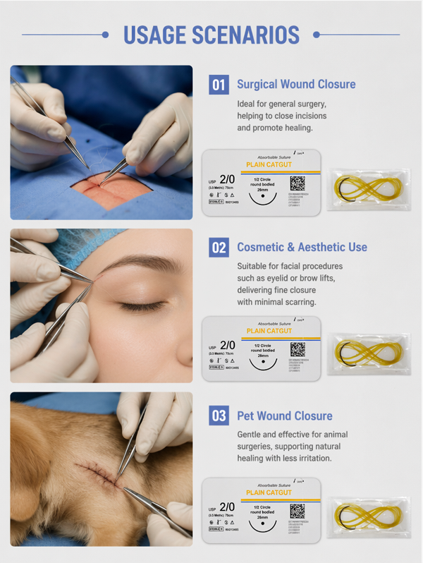 Factory Direct Sales Plain Catgut Absorbable Surgical Sutures Ce Certified Medical Grade Sterile Usp4-7/0 Model For General Surgery Source Factory