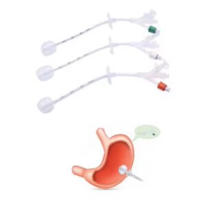 Master Medical | Master Silicone Disposable Gastrostomy Feeding Tube Master Medical | Master Silicone Disposable Gastrostomy Feeding Tube