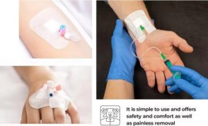 Master Medical | Master Disposable Transparent IV Cannula Fixed Dressing Master Medical | Master Disposable Transparent IV Cannula Fixed Dressing